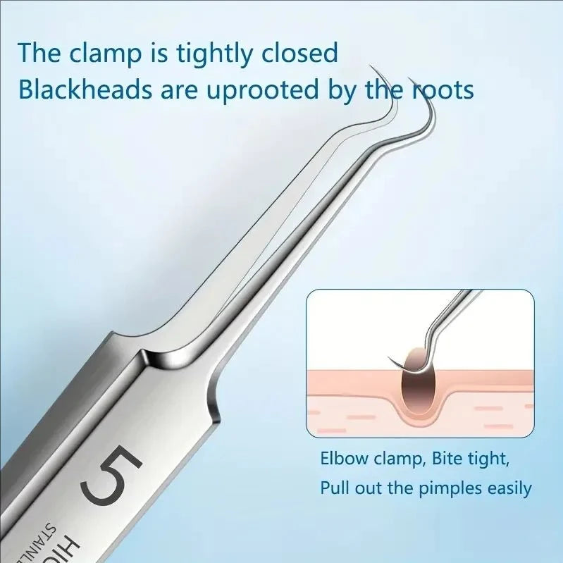 LuxeSkin – 8-Piece Blackhead & Acne Extractor Kit