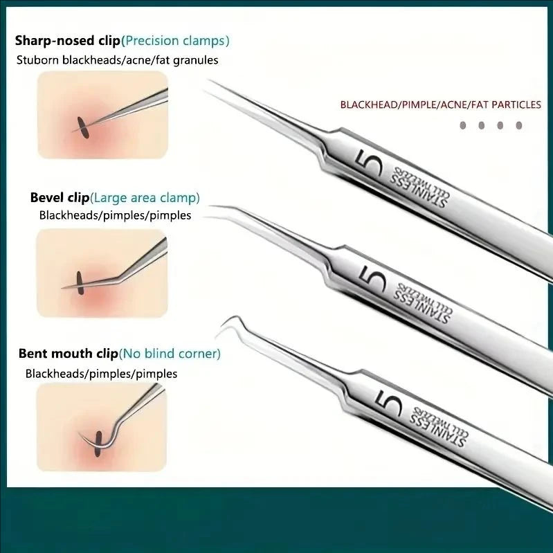 LuxeSkin – 8-Piece Blackhead & Acne Extractor Kit