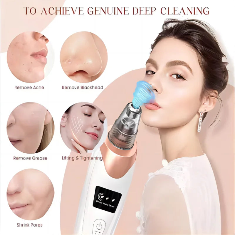 LUXEGlow Luxury Facial Vacuum – Blackhead Remover & Deep Pore Cleaner
