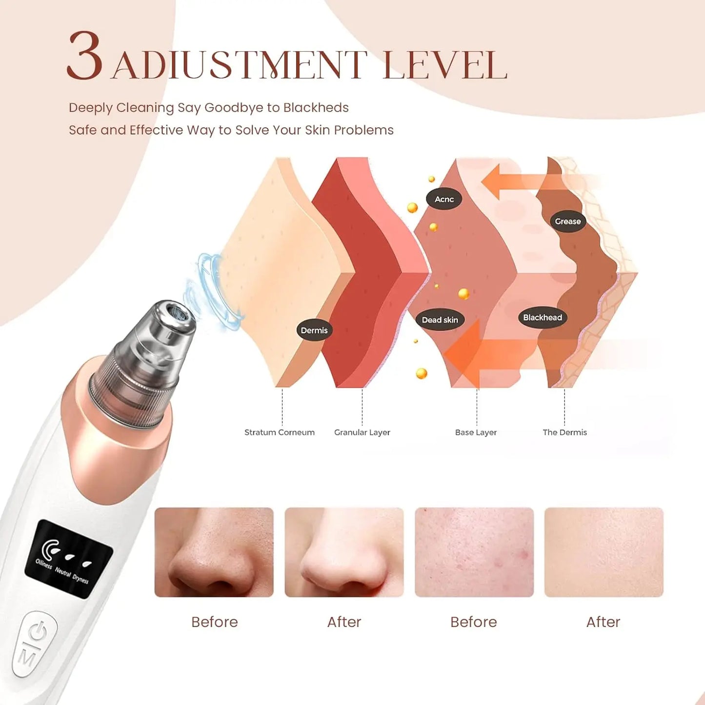 LUXEGlow Luxury Facial Vacuum – Blackhead Remover & Deep Pore Cleaner