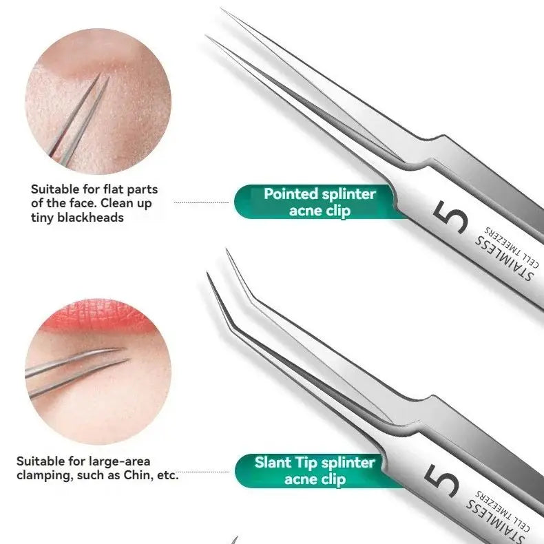 LuxeSkin – 8-Piece Blackhead & Acne Extractor Kit