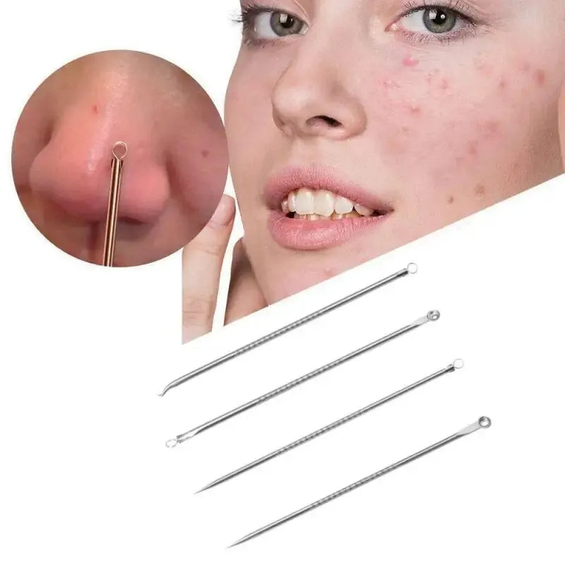 PureSkin – 4-Piece Stainless Steel Acne & Pimple Removal Needle Set