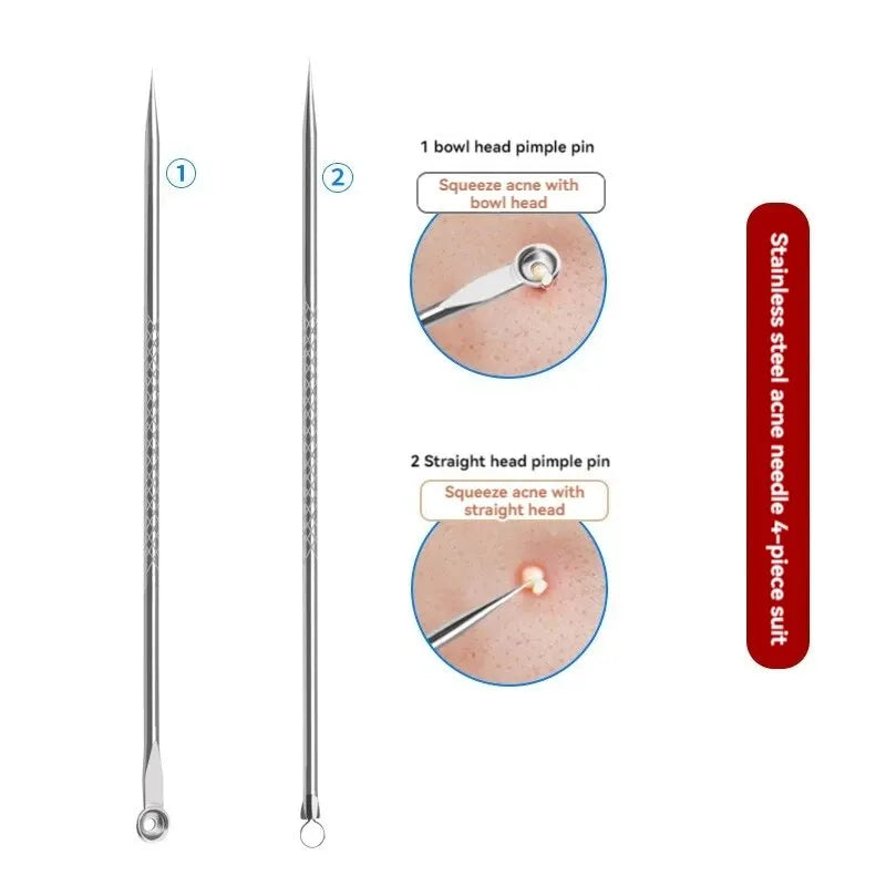 PureSkin – 4-Piece Stainless Steel Acne & Pimple Removal Needle Set