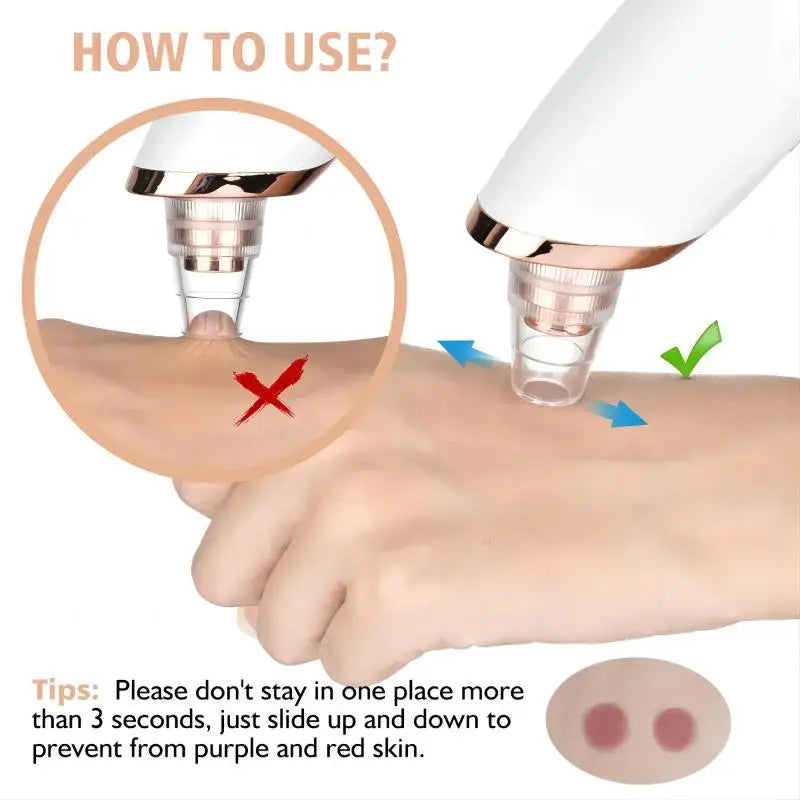 LUXEGlow Luxury Facial Vacuum – Blackhead Remover & Deep Pore Cleaner