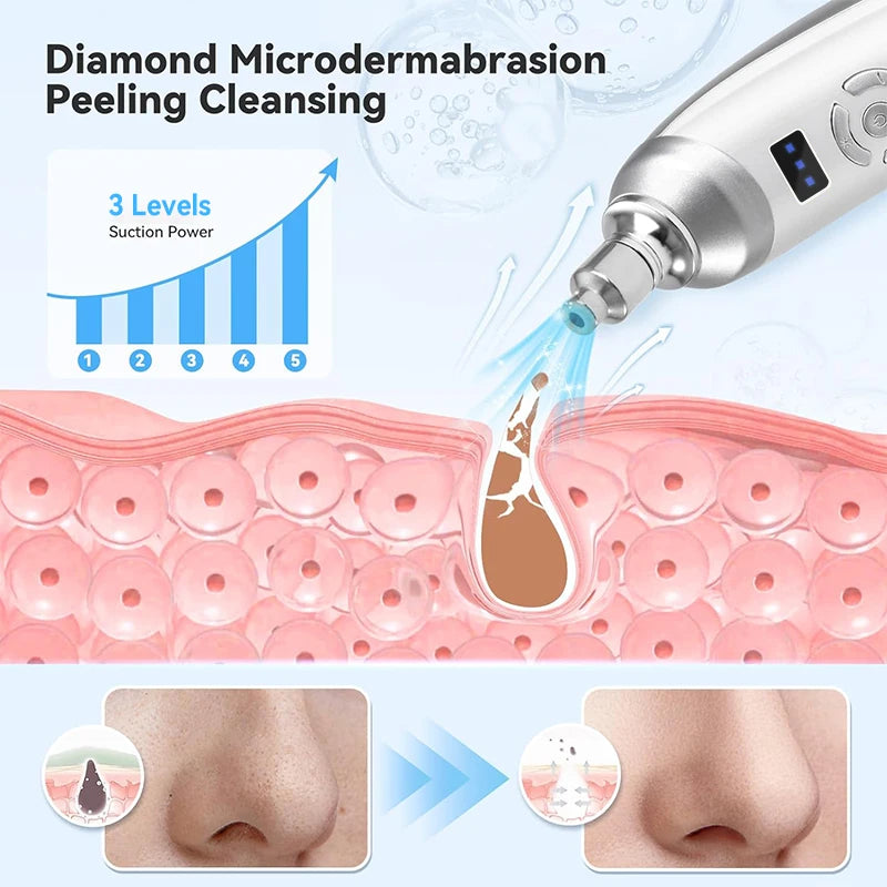 Professional Diamond Microdermabrasion & Deep Facial Cleansing Device
