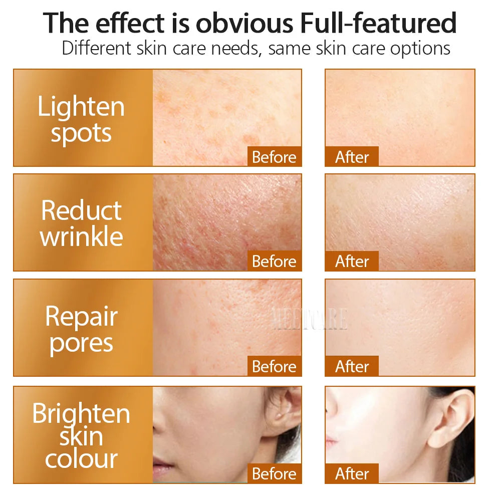 192 Microneedle Derma Roller – 0.25mm for Face, Scars & Skin Rejuvenation